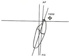 Manual Illustration